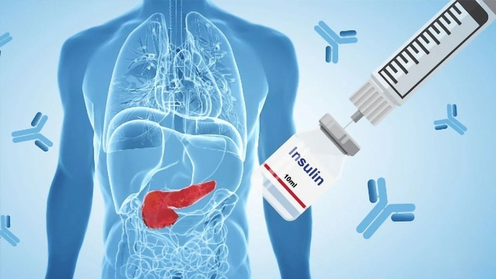 Tác hại của insulin ngoại sinh đối với người bệnh tiểu đường. Quan trọng! 1
