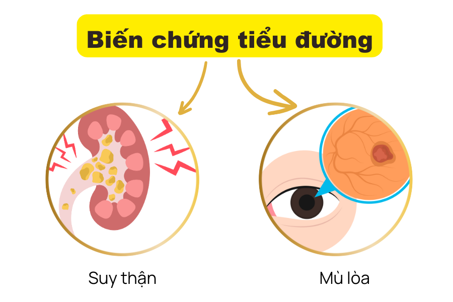 Tiểu đường – Nguyên nhân hàng đầu gây mù lòa và suy thận 1